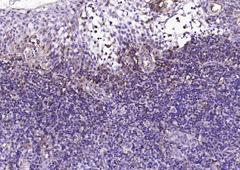 CD39/ENTPD1 Recombinant Rabbit Monoclonal Antibody