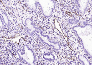 CD39/ENTPD1 Recombinant Rabbit Monoclonal Antibody