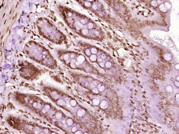 HnRNP A2B1 Rabbit Polyclonal Antibody