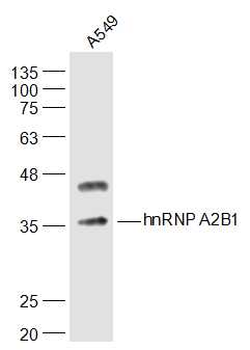 HnRNP A2B1 Rabbit Polyclonal Antibody