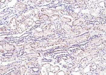 CFH Rabbit Polyclonal Antibody