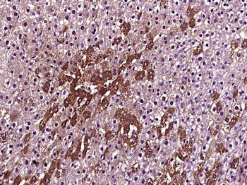 CFH Rabbit Polyclonal Antibody