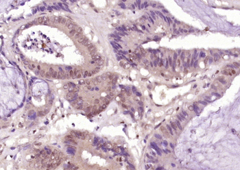 CDX2+3 Rabbit Polyclonal Antibody