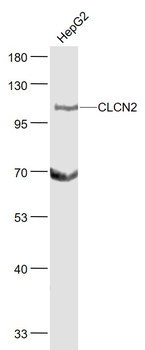 CLCN2 Rabbit Polyclonal Antibody