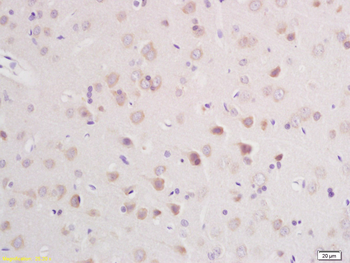 CLCN3 Rabbit Polyclonal Antibody