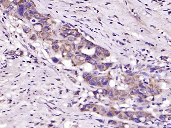 RNF216 Rabbit Polyclonal Antibody