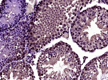 RanBP1 Rabbit Polyclonal Antibody