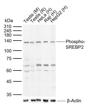Phospho-SREBP2 (Thr334) Rabbit Polyclonal Antibody