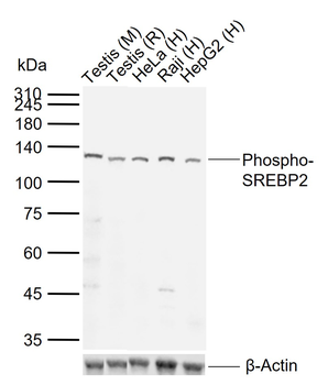 Phospho-SREBP2 (Thr334) Rabbit Polyclonal Antibody