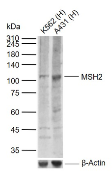 MSH2 Rabbit Polyclonal Antibody