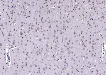 AEBP1 Rabbit Polyclonal Antibody