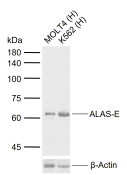 ALAS-E Rabbit Polyclonal Antibody