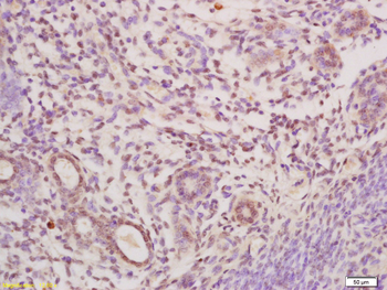 MtTF1/TFAM Rabbit Polyclonal Antibody