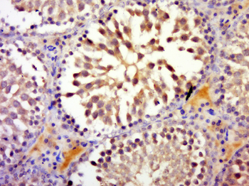 RNF17 Rabbit Polyclonal Antibody