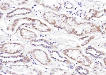 MARCH5 Rabbit Polyclonal Antibody