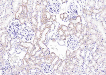 MARCH5 Rabbit Polyclonal Antibody