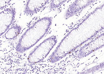 TIMP1 Mouse Monoclonal Antibody