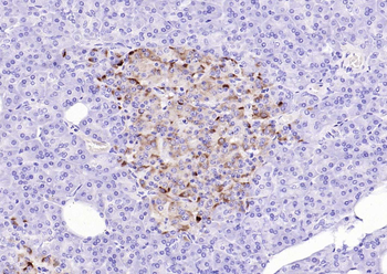 TIMP1 Mouse Monoclonal Antibody