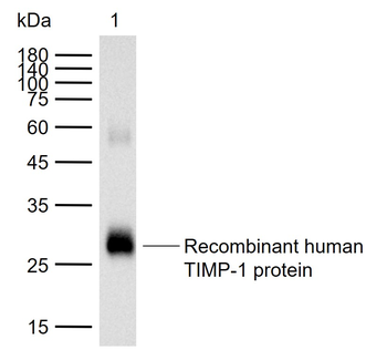 TIMP1 Mouse Monoclonal Antibody