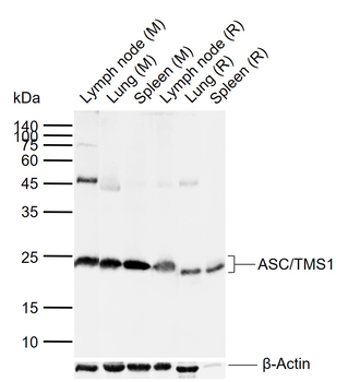 ASC/TMS1 Rabbit Polyclonal Antibody