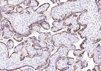 Human HCG-α Mouse Monoclonal Antibody
