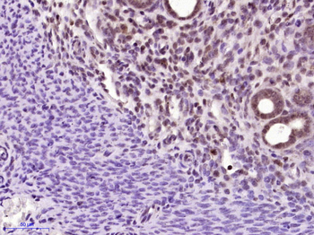 CPSF4 Rabbit Polyclonal Antibody