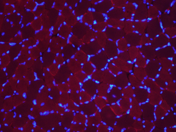MUL1 Rabbit Polyclonal Antibody