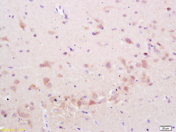 Phospho-STMN2 (Ser50) Rabbit Polyclonal Antibody