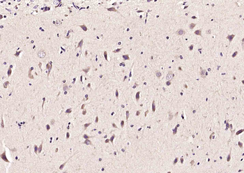 PACRG Rabbit Polyclonal Antibody