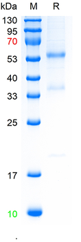 Recombinant Bovine Haptoglobin protein, C-His (HEK293)