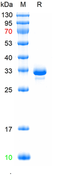 Recombinant human PROC protein, N-His