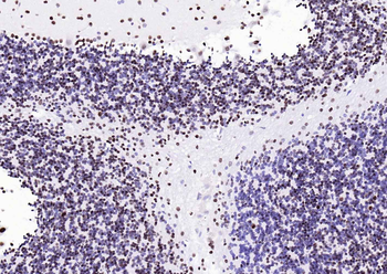 TARDBP Recombinant Rabbit Monoclonal Antibody