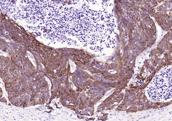Keratin 14 Recombinant Rabbit Monoclonal Antibody