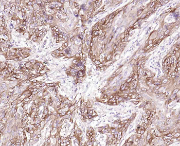 Keratin 14 Recombinant Rabbit Monoclonal Antibody