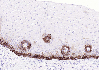 Keratin 14 Recombinant Rabbit Monoclonal Antibody