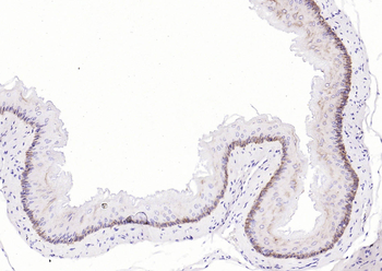 Keratin 14 Recombinant Rabbit Monoclonal Antibody