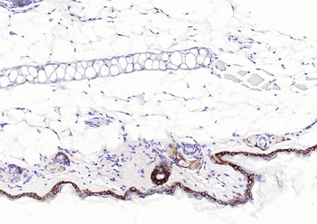 Keratin 14 Recombinant Rabbit Monoclonal Antibody