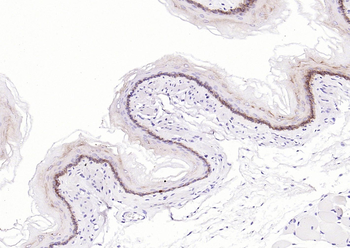 Keratin 14 Recombinant Rabbit Monoclonal Antibody