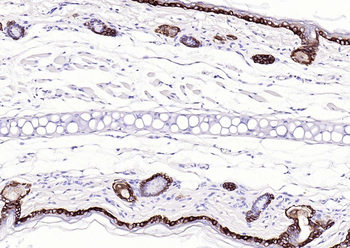 Keratin 14 Recombinant Rabbit Monoclonal Antibody
