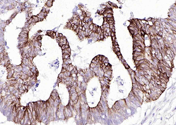 Cytokeratin 20 Mouse Monoclonal Antibody