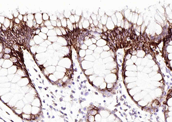 Cytokeratin 20 Mouse Monoclonal Antibody