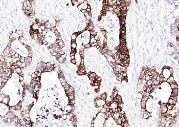 Cytokeratin 20 Mouse Monoclonal Antibody