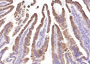 Cytokeratin 20 Mouse Monoclonal Antibody