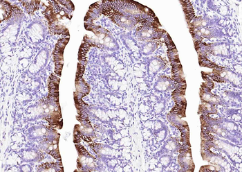 Cytokeratin 20 Mouse Monoclonal Antibody