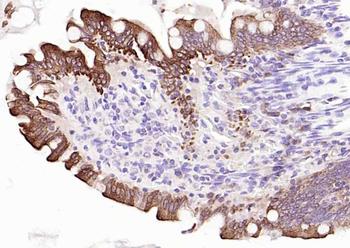 Cytokeratin 20 Mouse Monoclonal Antibody