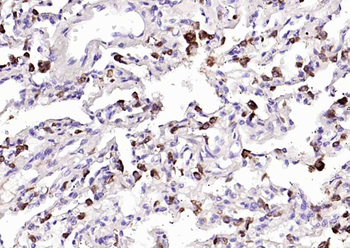 NAPSIN A Mouse Monoclonal Antibody