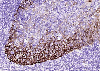 Cytokeratin 14 Mouse Monoclonal Antibody
