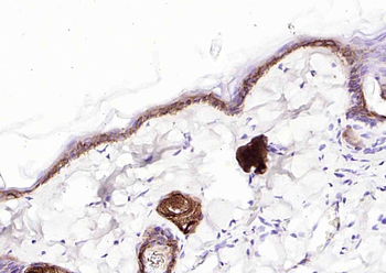 Cytokeratin 14 Mouse Monoclonal Antibody