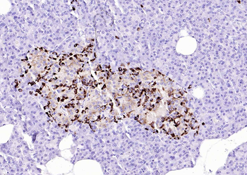 CHGA Mouse Monoclonal Antibody