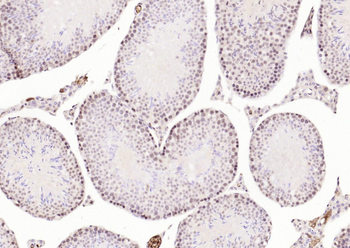 PMS2 Mouse Monoclonal Antibody